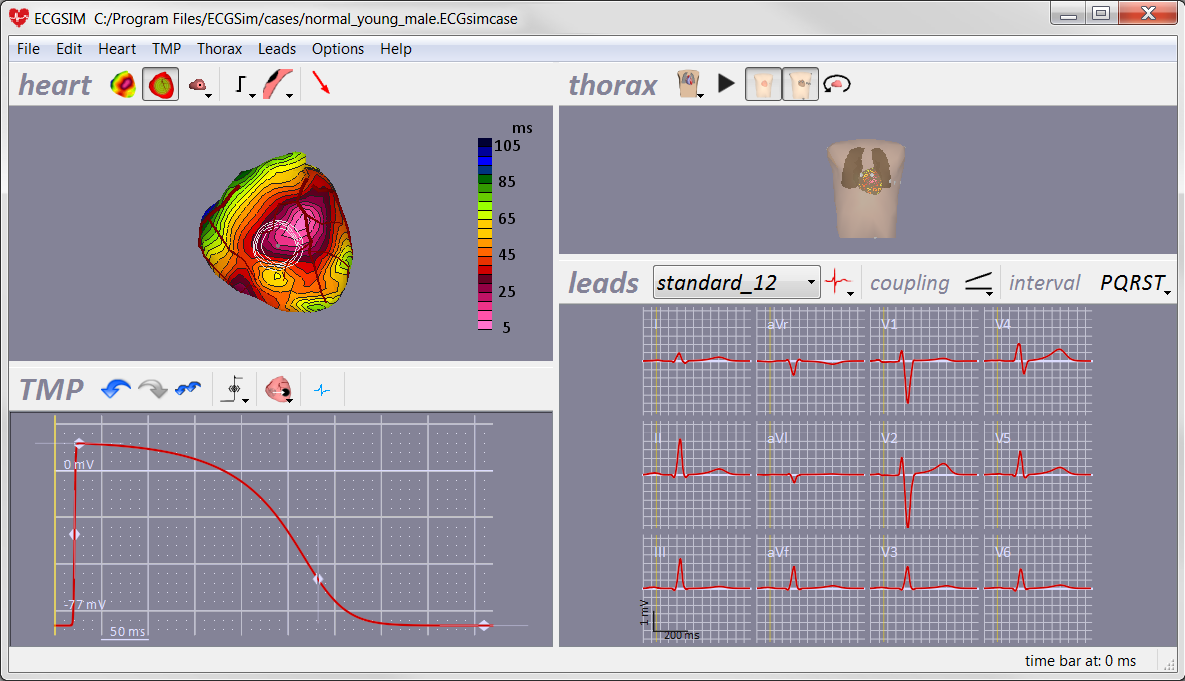 Screen dump of the ECGSIM main window