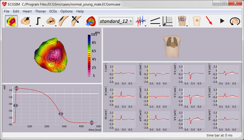 Screen dump of the ECGSIM main window